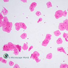 Mouth Smear Under the Microscope Mouth Smear Under the Microscope