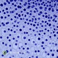 Onion Root Tips under the Microscope Onion Root Tips under the Microscope