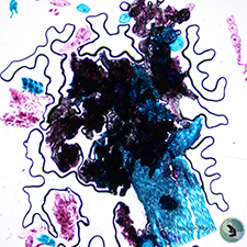 Pepper Epidermis Under Microscope Pepper Epidermis Under Microscope
