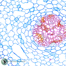 Microscope prepared slides for biology Biology Basic Prepared Slide Kit
