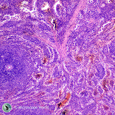 Mammal Spleen prepared slide under the Microscope Mammal Spleen under the Microscope