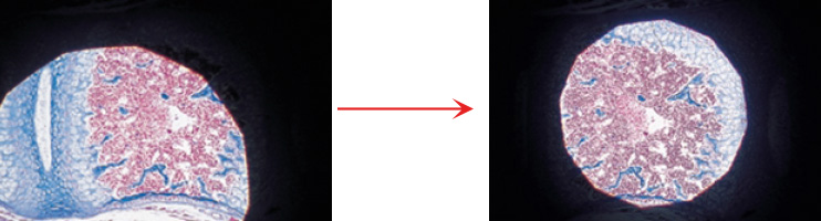 Properly Centered Microscope Condenser